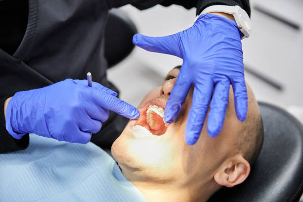 Best Emergency Dental Care for Broken or Chipped Teeth in Boutte, LA